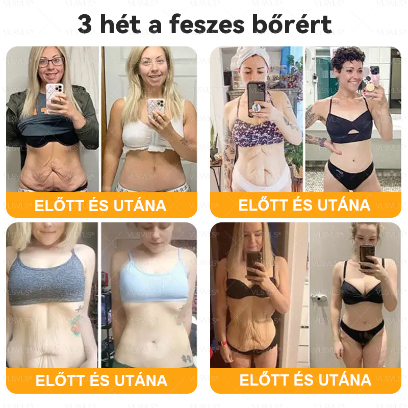 🔥Magyarországon készült és innen szállítjuk ✨ VLSVLS® Méhméreg Bőrhelyreállító Krém 🔥 UTOLSÓ NAP – 80% KEDVEZMÉNY