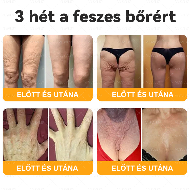 🔥Magyarországon készült és innen szállítjuk ✨ VLSVLS® Méhméreg Bőrhelyreállító Krém 🔥 UTOLSÓ NAP – 80% KEDVEZMÉNY