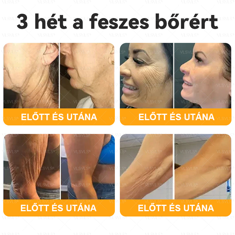 🔥Magyarországon készült és innen szállítjuk ✨ VLSVLS® Méhméreg Bőrhelyreállító Krém 🔥 UTOLSÓ NAP – 80% KEDVEZMÉNY