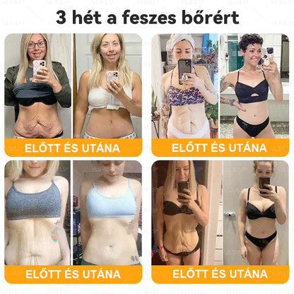 🔥Magyarországon készült és innen szállítjuk ✨ VLSVLS® Méhméreg Bőrhelyreállító Krém 🔥 UTOLSÓ NAP – 80% KEDVEZMÉNY
