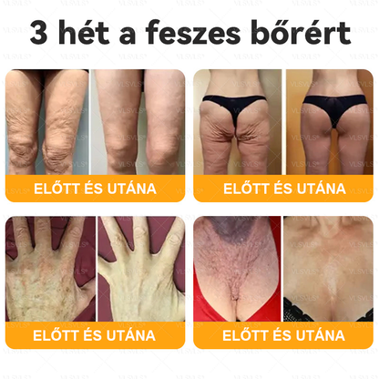 🔥Magyarországon készült és innen szállítjuk ✨ VLSVLS® Méhméreg Bőrhelyreállító Krém 🔥 UTOLSÓ NAP – 80% KEDVEZMÉNY