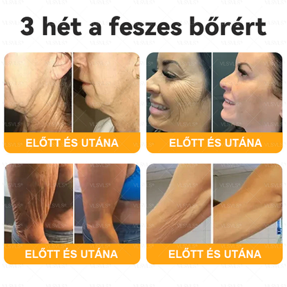 🔥Magyarországon készült és innen szállítjuk ✨ VLSVLS® Méhméreg Bőrhelyreállító Krém 🔥 UTOLSÓ NAP – 80% KEDVEZMÉNY