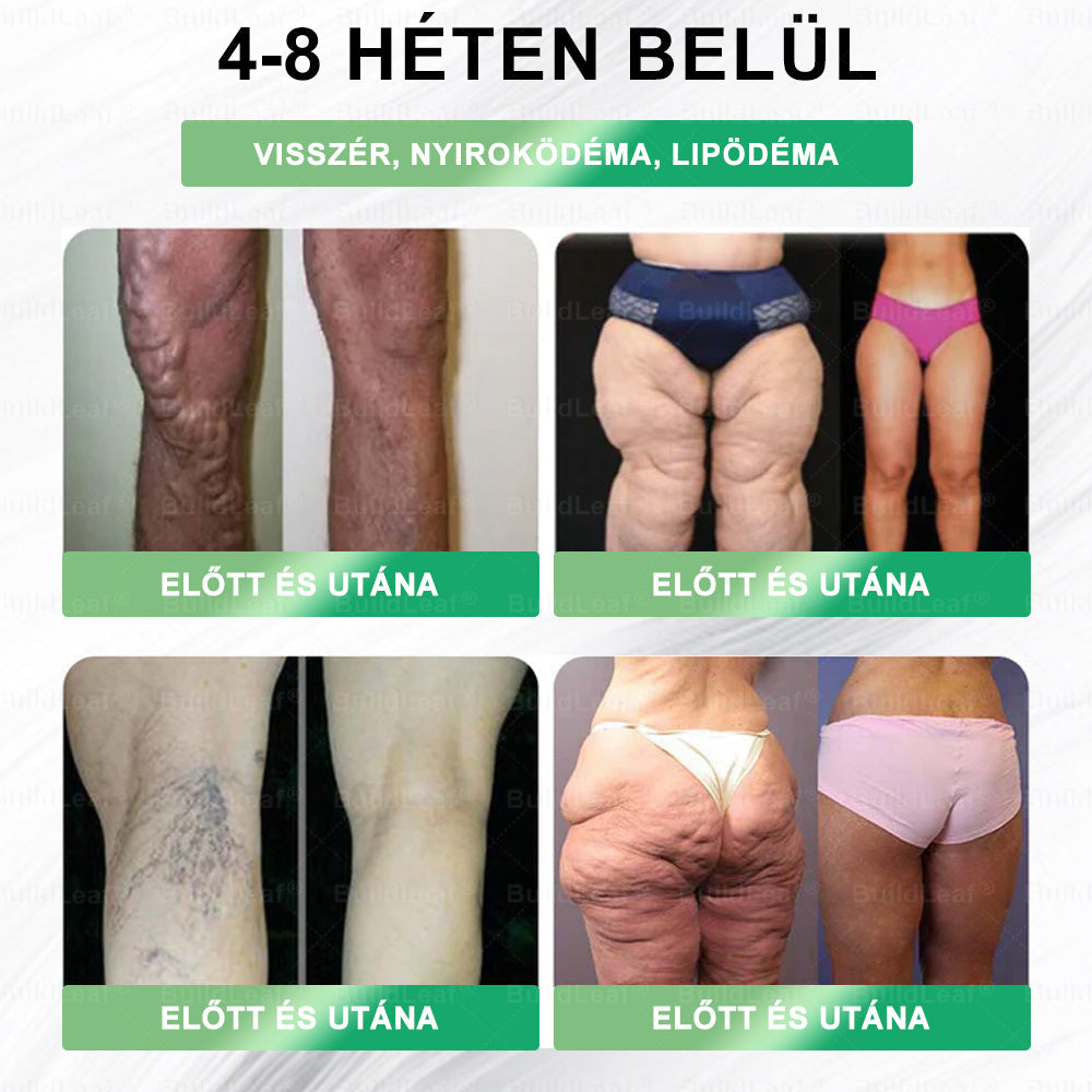 𝑩𝒖𝒊𝒍𝒅𝑳𝒆𝒂𝒇® 🎁 Már csak 5 doboz maradt! További 50% kedvezményt kínálunk! Hozd magad formába és egészségessé. Ha most lemaradsz, csak jövőre lesz másik lehetőséged✅