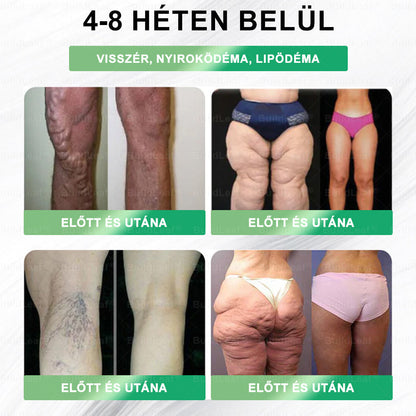 𝑩𝒖𝒊𝒍𝒅𝑳𝒆𝒂𝒇® 🎁 Már csak 5 doboz maradt! További 50% kedvezményt kínálunk! Hozd magad formába és egészségessé. Ha most lemaradsz, csak jövőre lesz másik lehetőséged✅